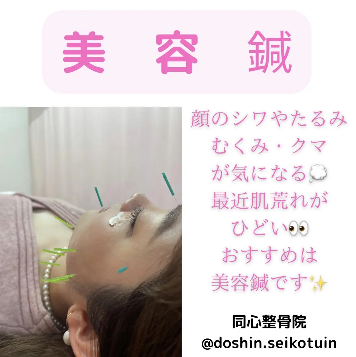 エステ リラク 同心整骨院 美容鍼・整体・小顔のエステ・リラクイメージ