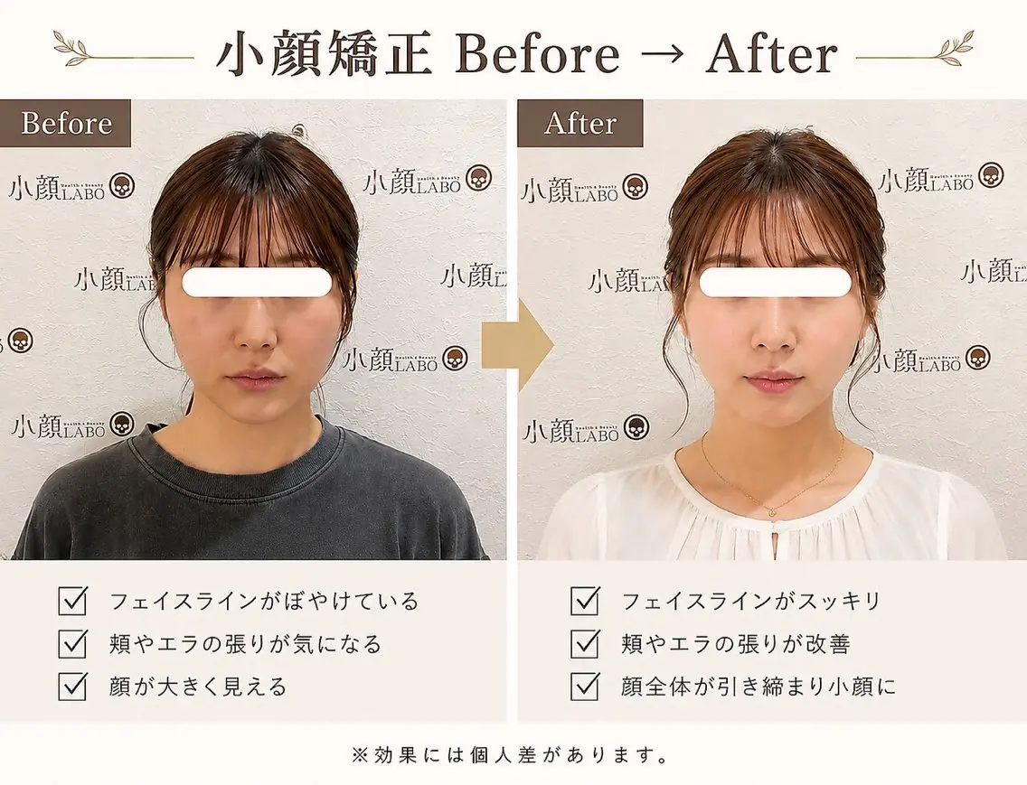心斎橋小顔矯正専門店 小顔LABO樫本昌彦のエステ・リラクイメージ