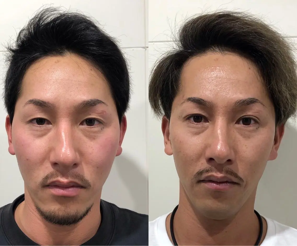 ロング ネイル マツエク・マツパ アイブロウ 小顔カット 【京整体 笑ゥ月〜 wemias〜長岡のエステ・リラクイメージ