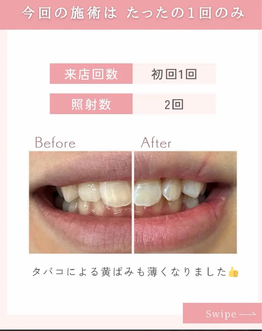 ホワイトニング 獅子🦁店長のその他イメージ