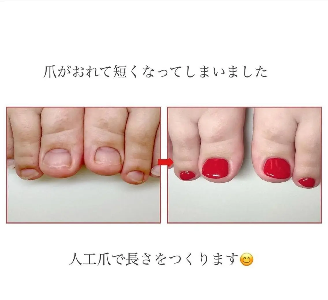 ネイル フットネイル ネイルサロン アリュームのネイルデザイン