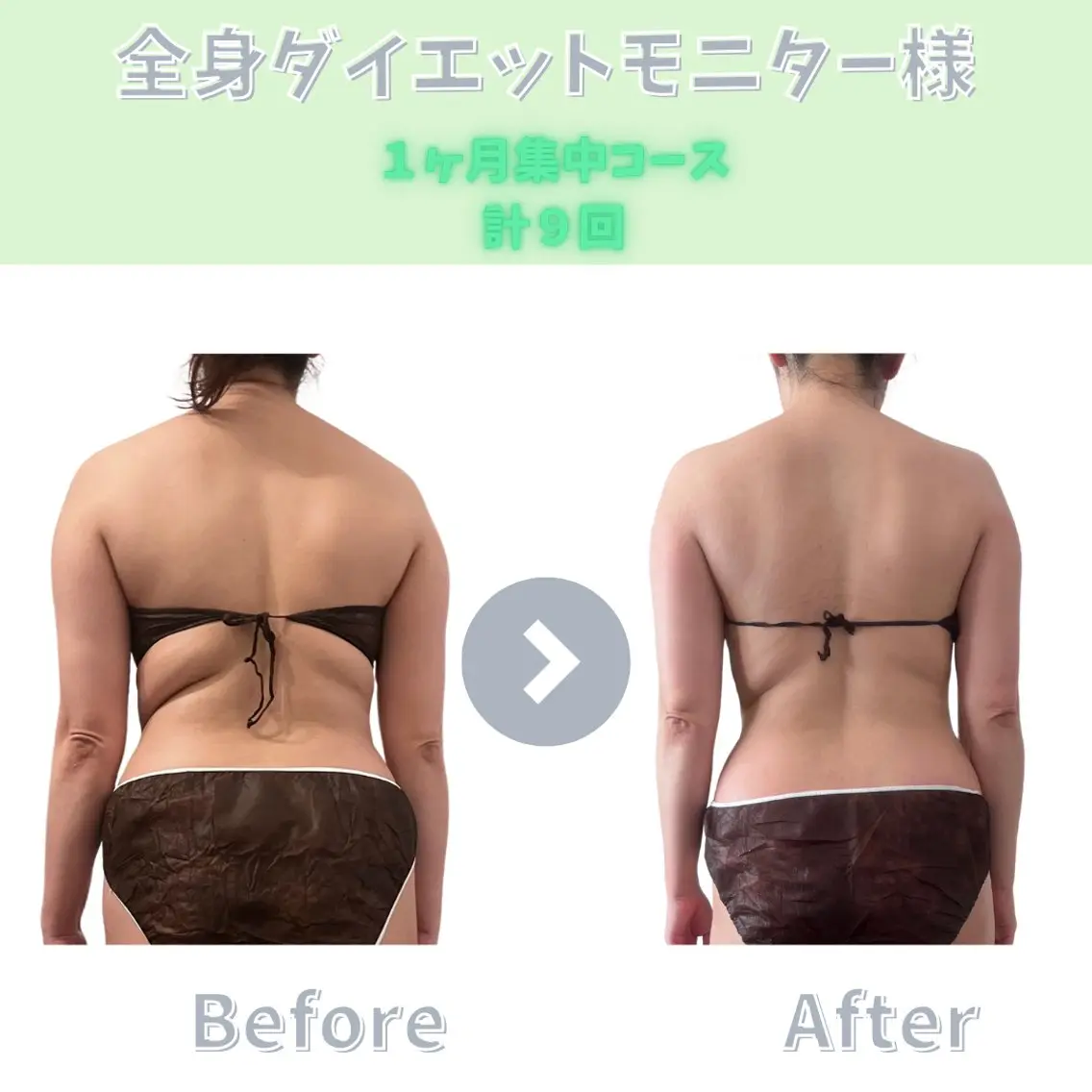 エステ 【ダイエット専門店】 エステサロン&Kのエステ・リラクイメージ