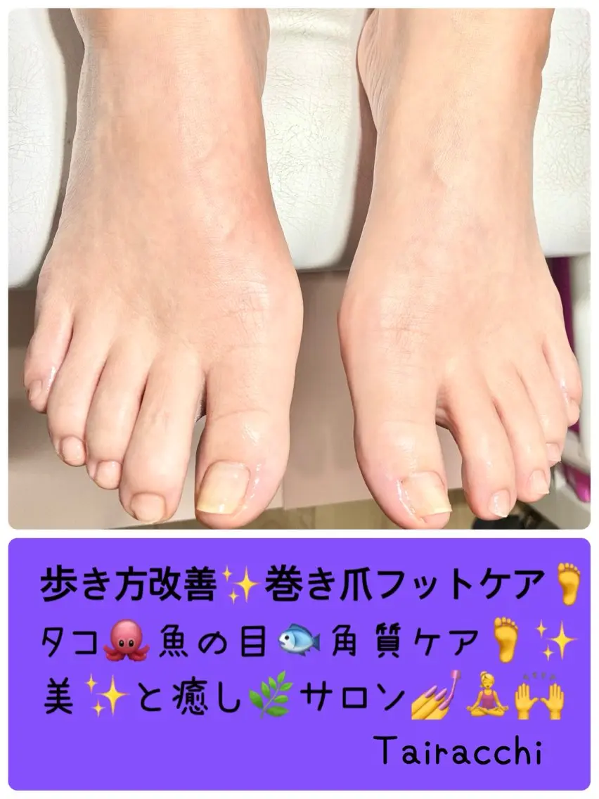 ネイル フットネイル フットネイル Tairacchi タイラッチのネイルデザイン