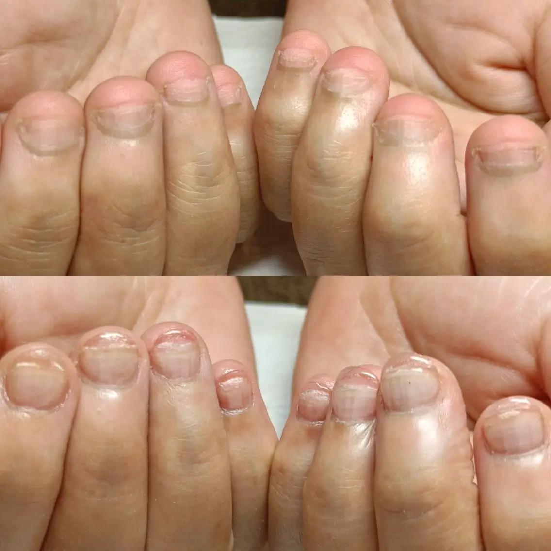ネイル ハンドネイル ハンドケア 深爪矯正/爪育成ケア manie nailのネイルデザイン