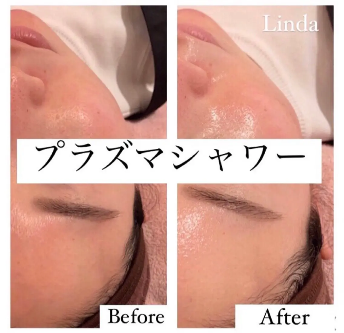 エステ 小顔&毛穴・肌質改善 LINDA西宮 AIのエステ・リラクイメージ