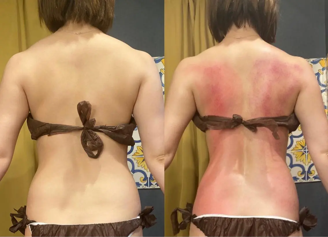 🔥徹底痩せ🔥 1回でも大幅変化‼️サーモシェイプdeepを使ったスペシャルオーダーメイドコースの写真