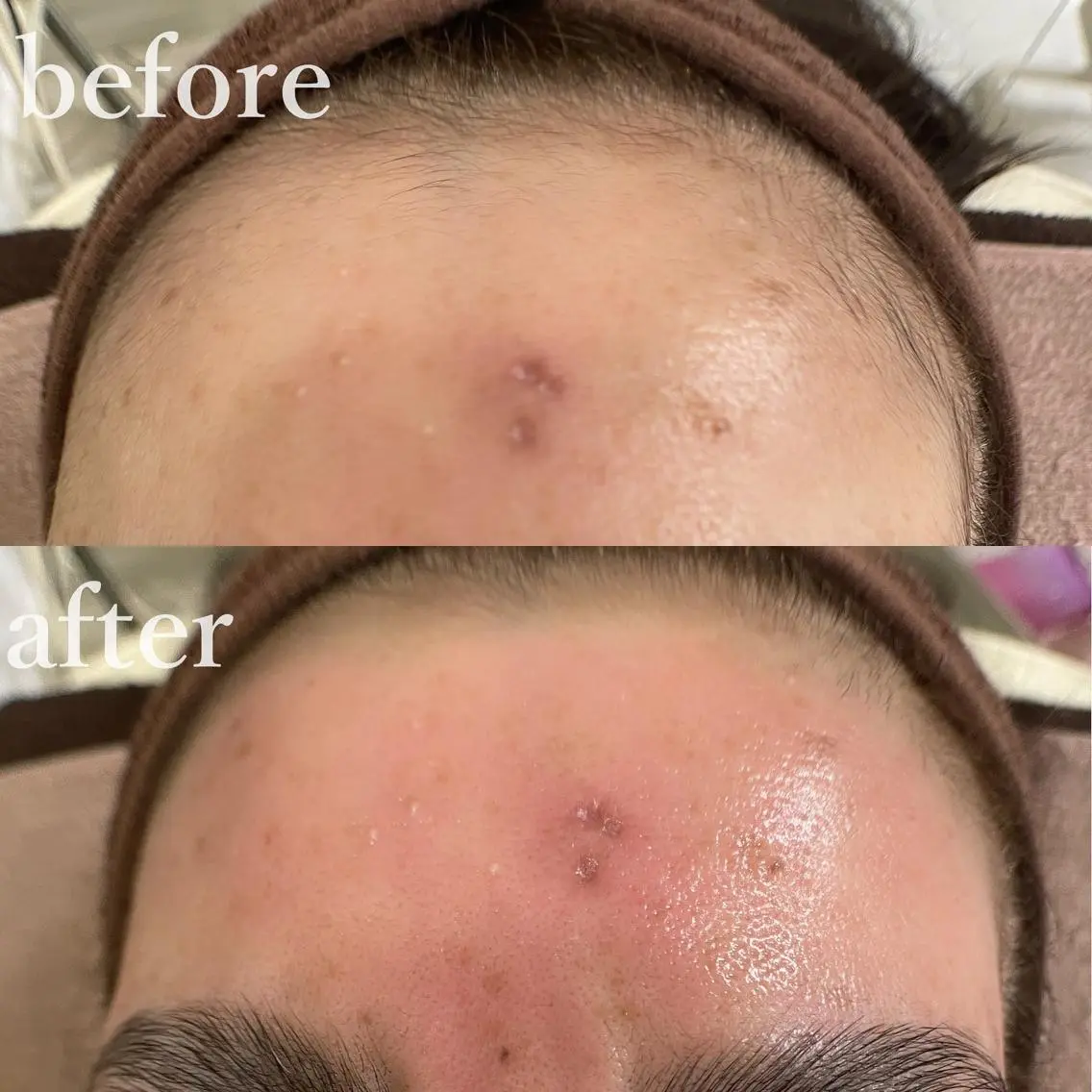 mish eyebrowのエステ・リラクイメージ