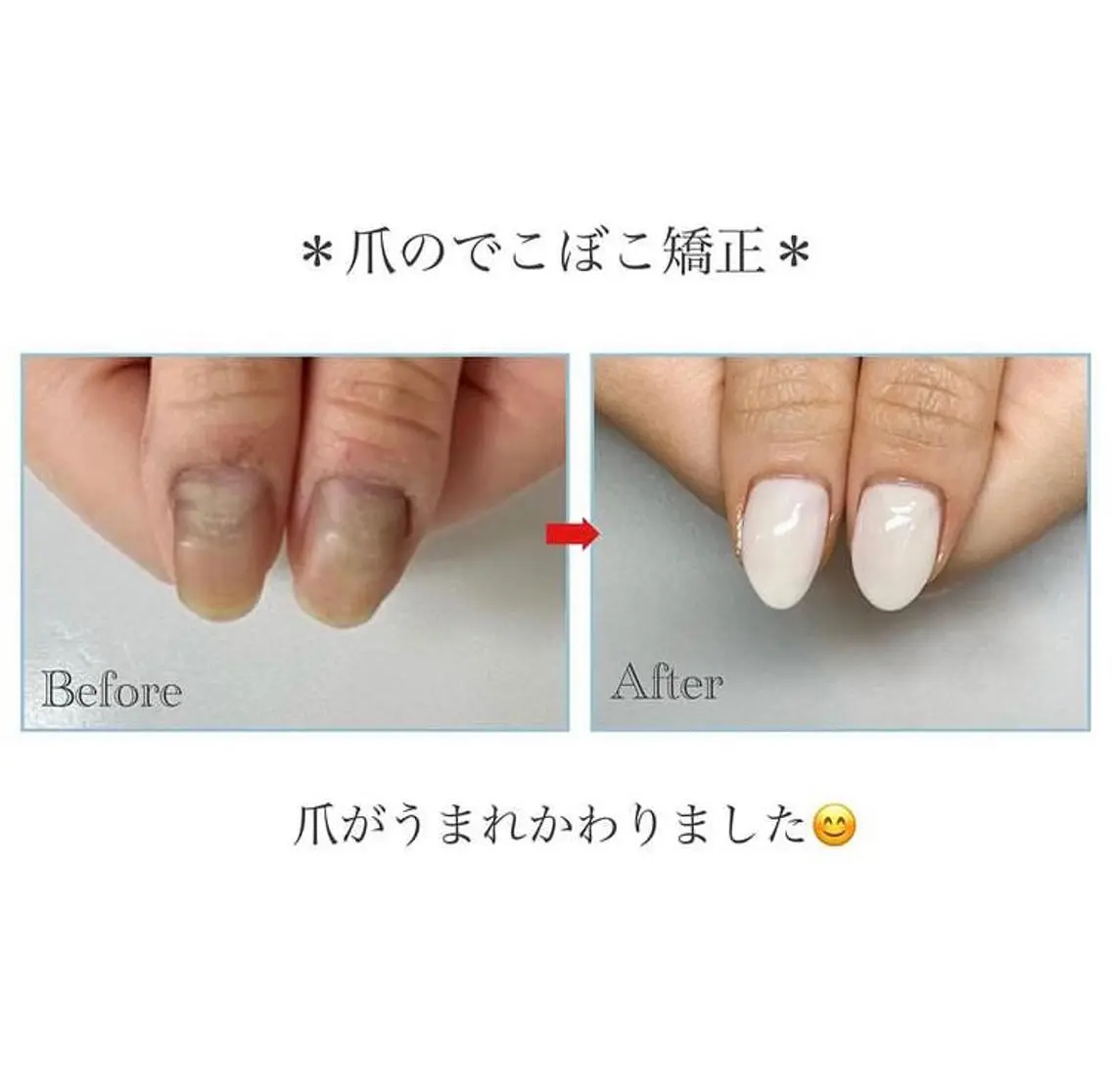 ネイル ネイルサロン アリュームのネイルデザイン