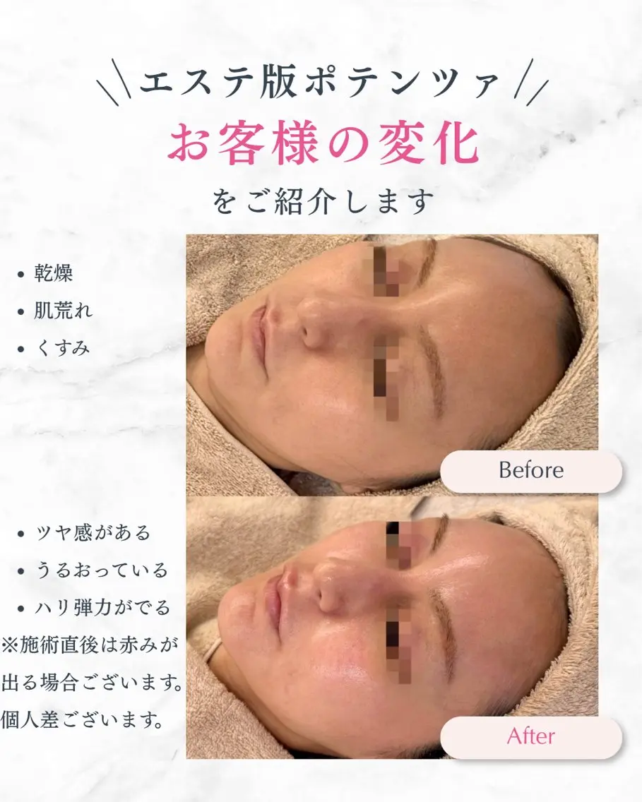 その他 北堀江/大人の本気の 肌質改善・温活ranのエステ・リラクイメージ