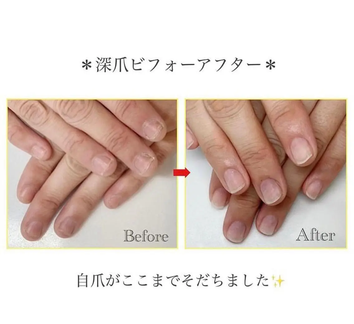 ネイル ネイルサロン アリュームのネイルデザイン