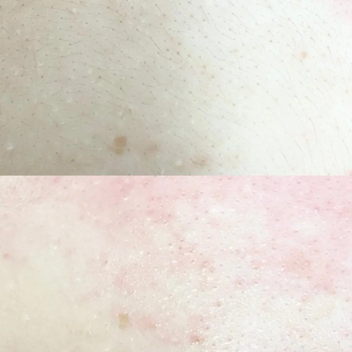 大人気🩶憧れの美背中になる背中wax✨の写真