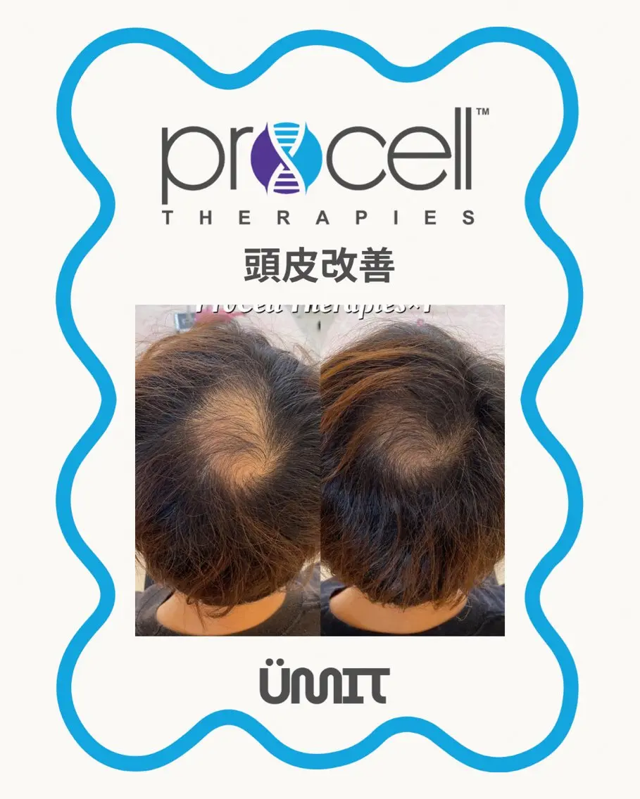 メンズ ヘッドスパ Ümit（ユミト） プロセルセラピーズのネイルデザイン