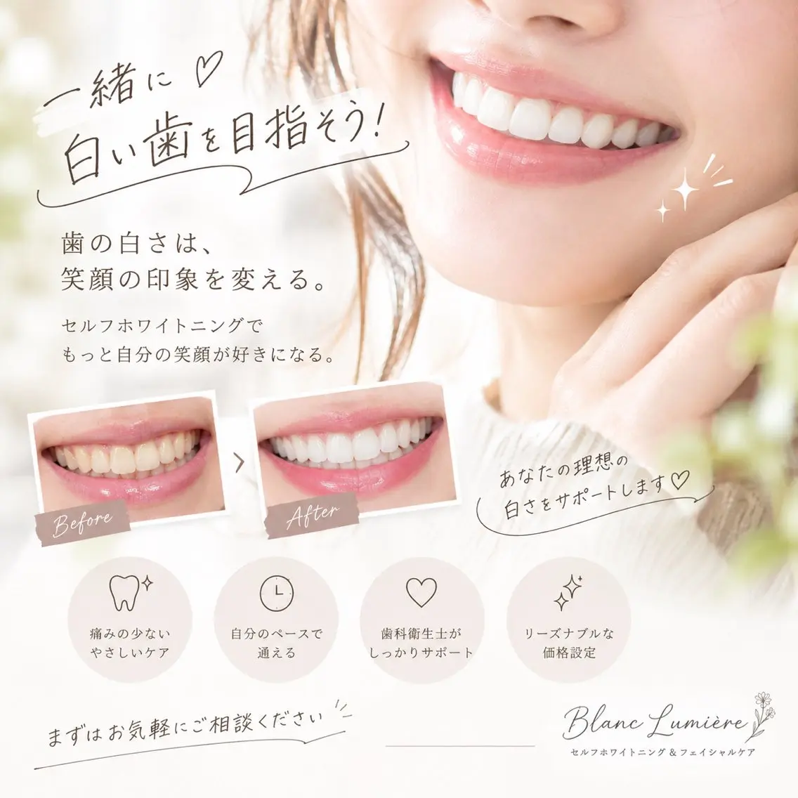 🦷✨セルフホワイトニング体験モニターの写真