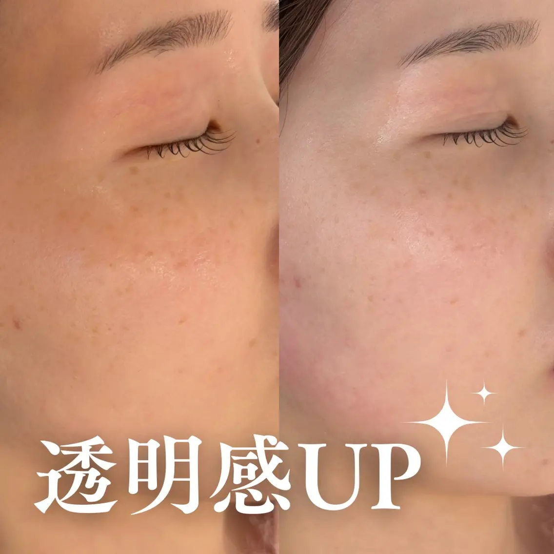 マツパ 垢抜け 眉×まつ毛 mizuhaのマツエク・マツパデザイン