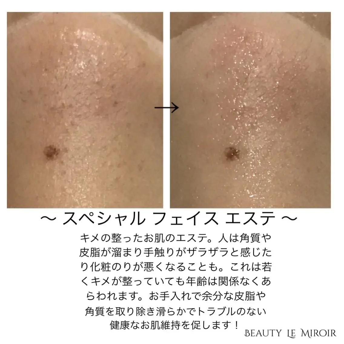 ビューティー ミロワールのエステ・リラクイメージ