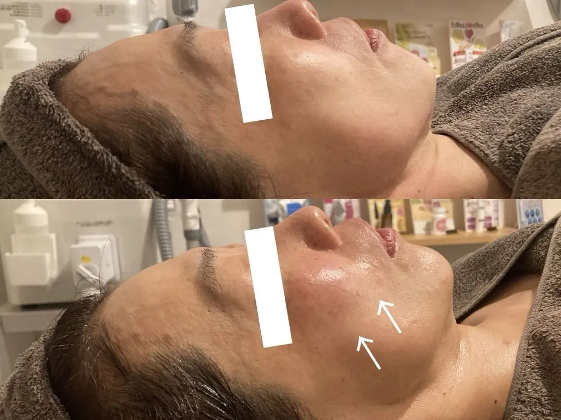 その他 CHERIE Akaneのエステ・リラクイメージ
