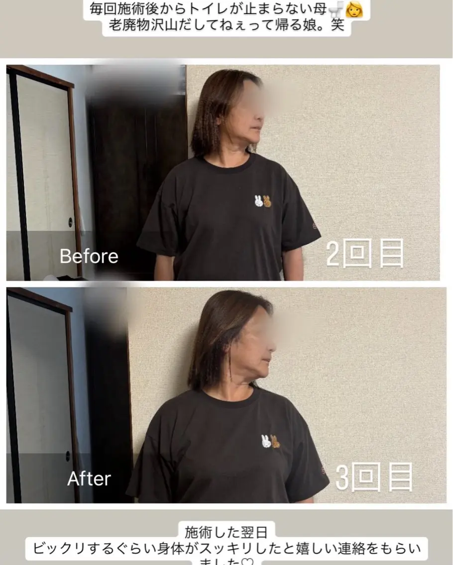 リラク 脳休ヘッド ストレッチのエステ・リラクイメージ