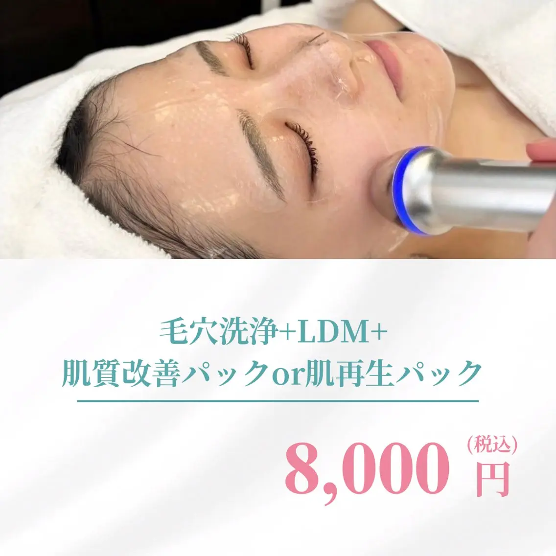【ミニモ限定】　毛穴洗浄+LDM+肌質改善パックor肌再生パック16,500円→8,000円の写真