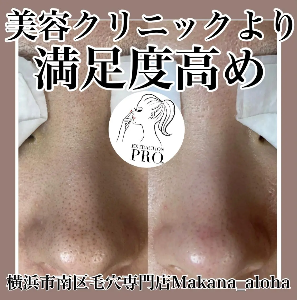 毛穴専門店 マカナアロハのエステ・リラクイメージ