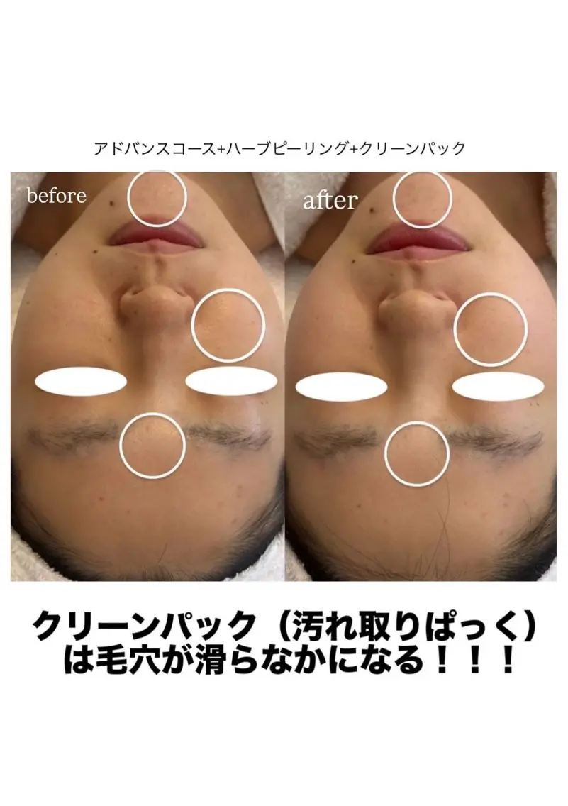 エステ メナード MIYUのその他イメージ