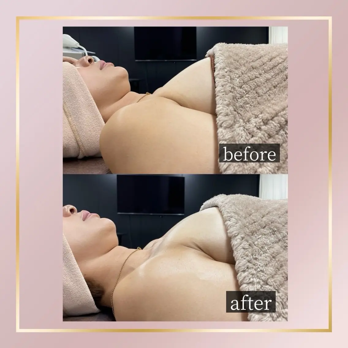 【バスト❣️全身コンパクト】最新NRマシ使用❣️全身コンパクトコース❣️（通常メニューよりお手軽に💖）の写真