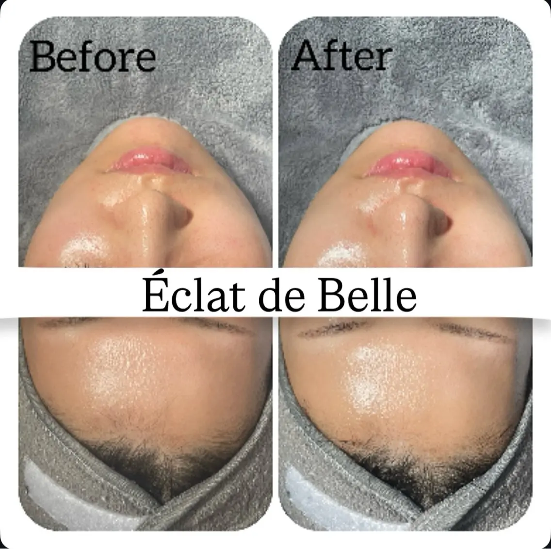 エステ Éclat de Belle🫧白玉肌のその他イメージ