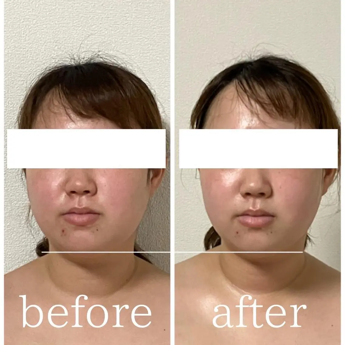 毛穴肌質ケアサロン Yourmeユアミーのエステ・リラクイメージ