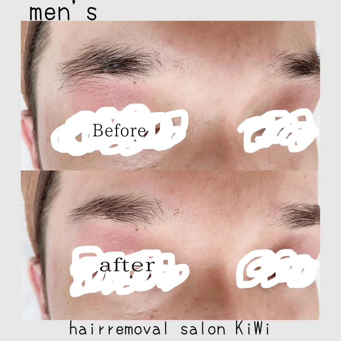 メンズ アイブロウ メンズアイブロウ 眉毛ワックス脱毛 脱毛サロン KiWiのエステ・リラクイメージ
