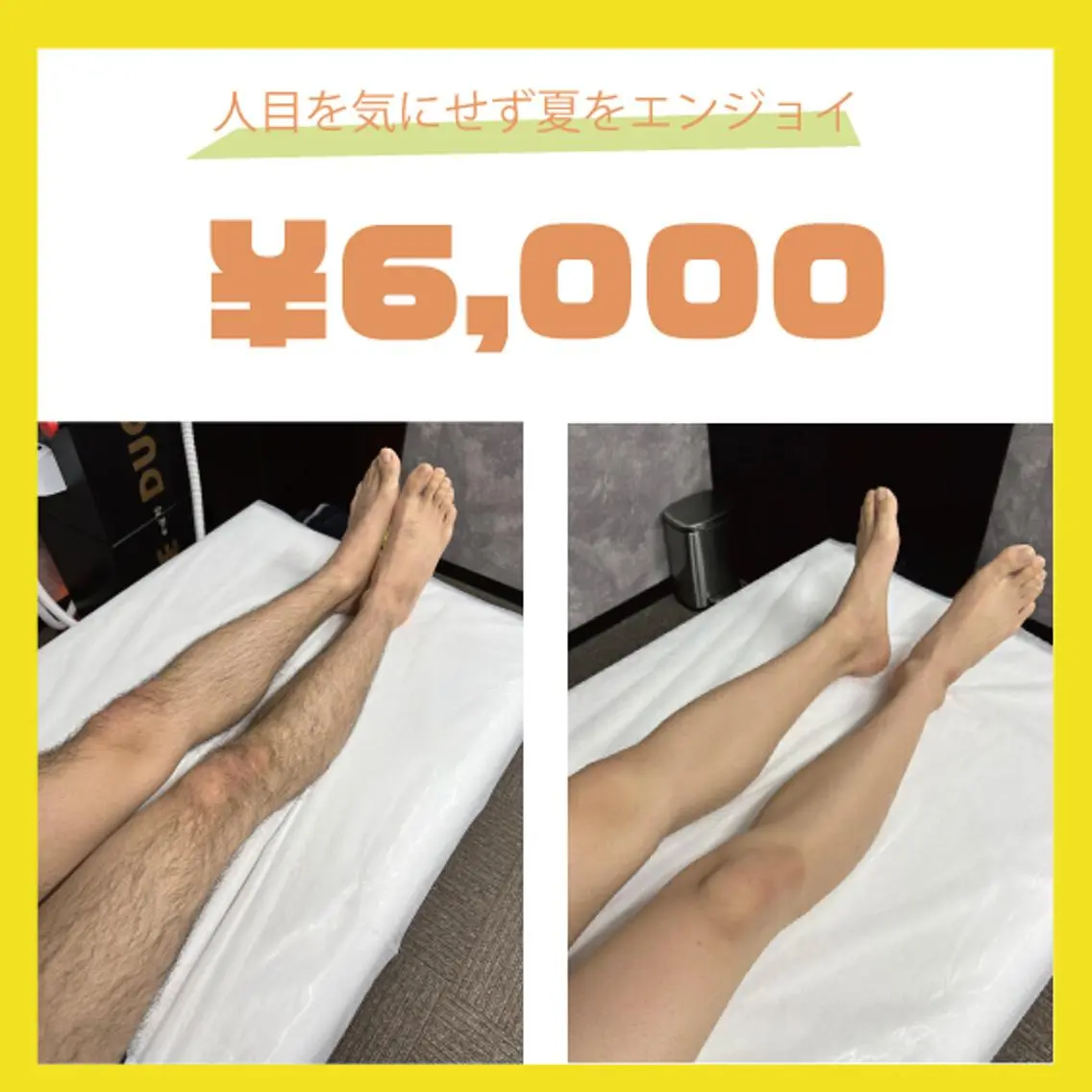 【今年の夏に向けて！】メンズ　足全体セットの写真