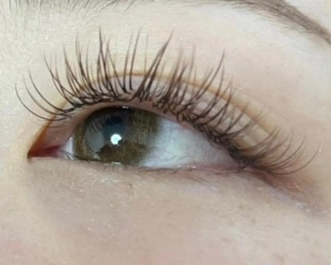 フラットラッシュ 120本の写真