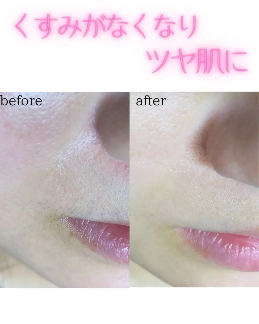 脱毛 Nao店長 /ルヴォルテ大須のマツエク・マツパデザイン
