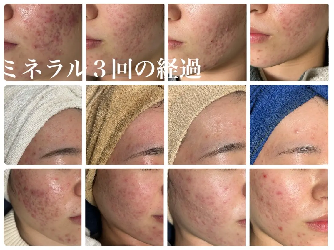 毛穴・肌質改善サロン ✨Tomaのエステ・リラクイメージ