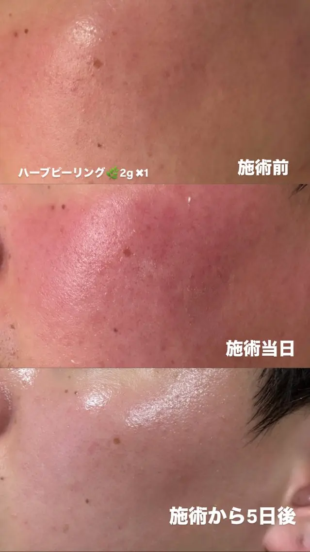エステ Gypsend サロンドジプセンドのエステ・リラクイメージ