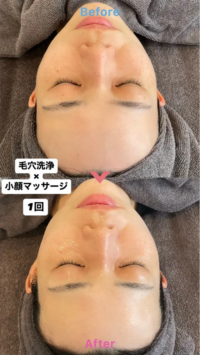 毛穴洗浄×小顔マッサージ【ツヤ・リフトアップ】の写真