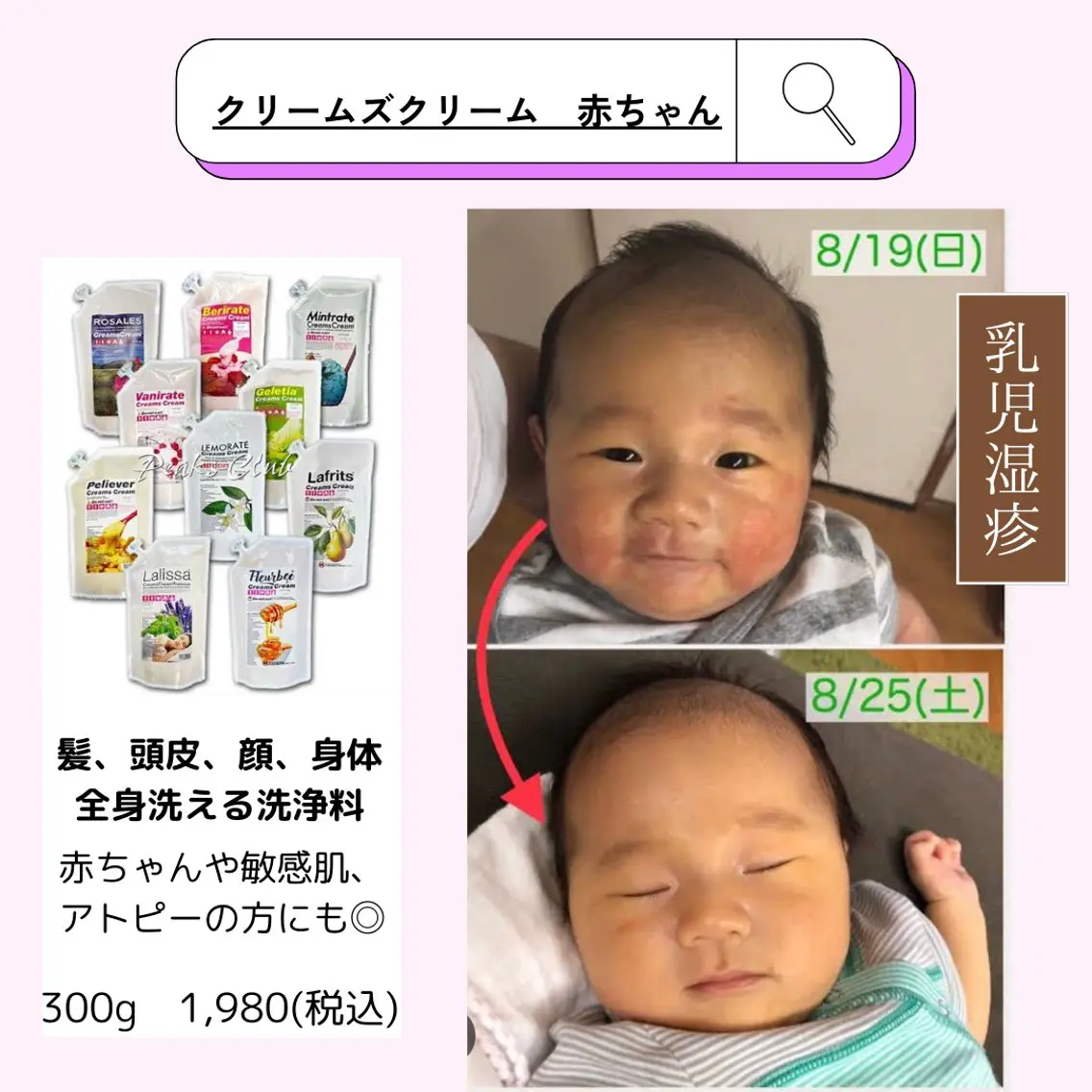 leolo武蔵浦和 肌質改善&脱毛のエステ・リラクイメージ