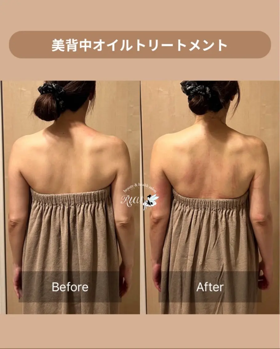 【頭痛、睡眠改善】 salon RUUのエステ・リラクイメージ