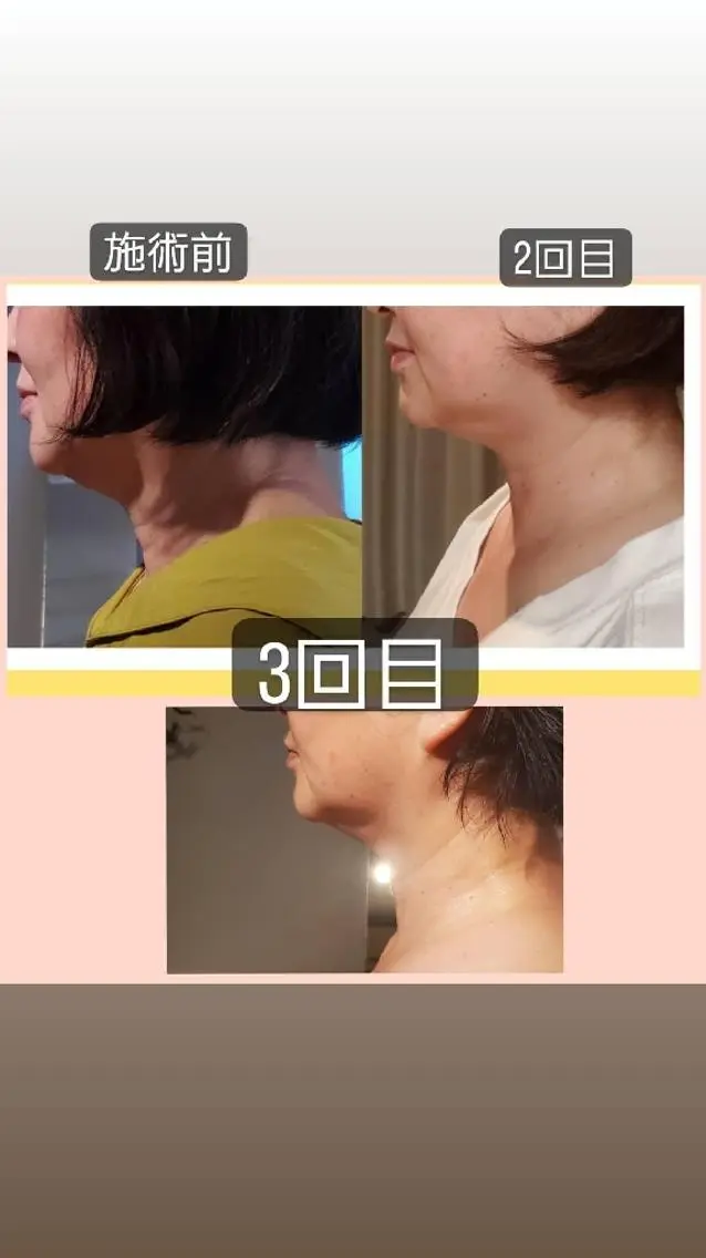 Face&body120分骨格矯正・指圧・オイルの写真