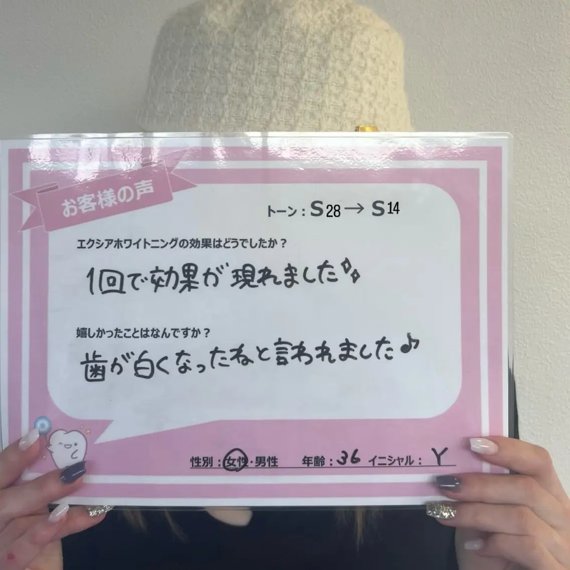 セルフホワイトニング エクシア熊本下通り店のその他イメージ