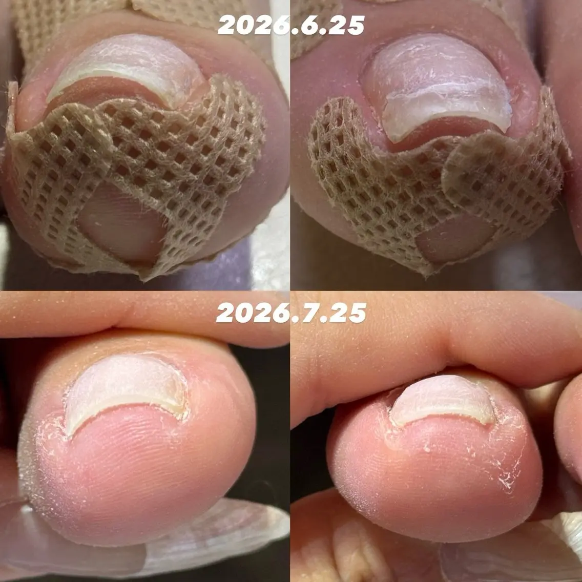 ネイル Mnailsalon フィルイン対応サロンのネイルデザイン