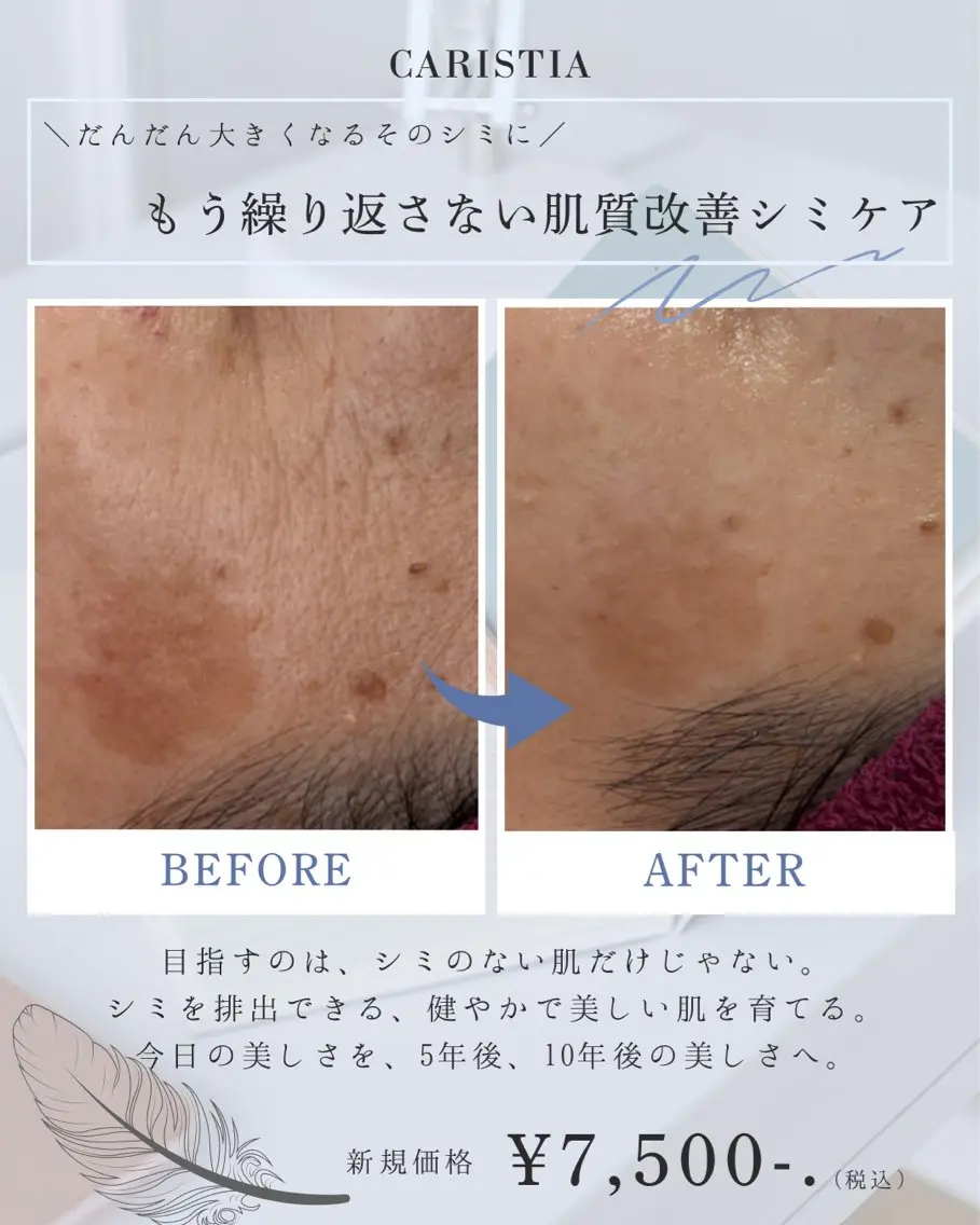 お悩みに合わせ、毛穴・シミ・小顔から最適な施術をオーダーメイドで施術。未来の輝く肌のために、プロの視点で最短距離のご提案の写真