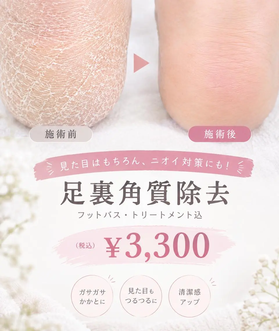 ✨フットバス付き角質ケア✨/足/角質/北浦和の写真