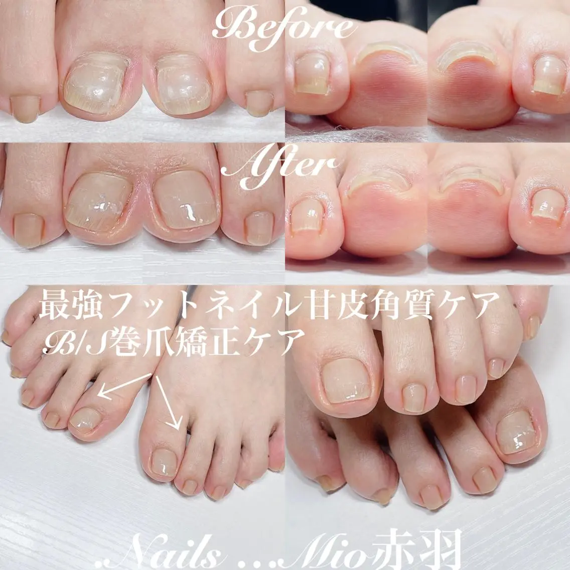 ネイル フットネイル フットネイル .Nails Mio 赤羽西ネイルサロンのネイルデザイン