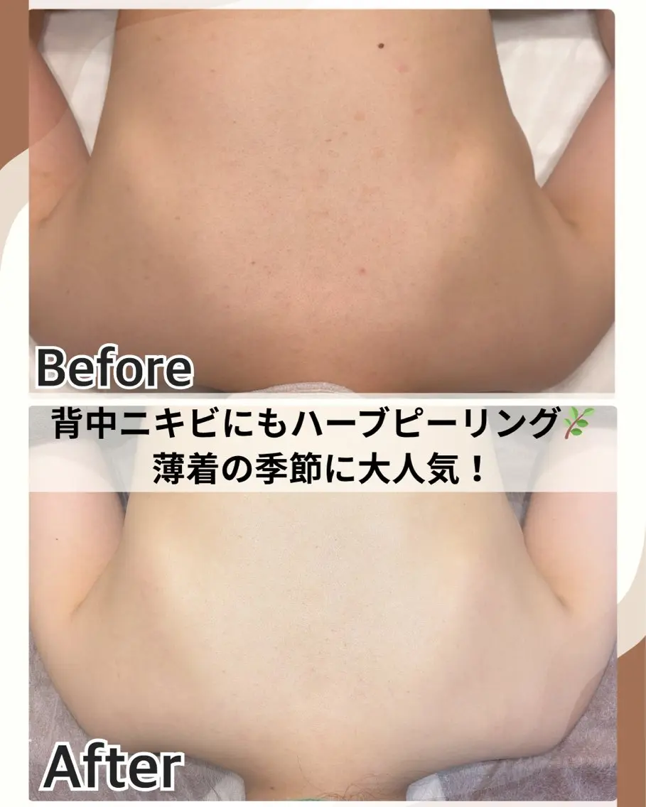 エステ 美肌管理専門Wax/ muroのエステ・リラクイメージ