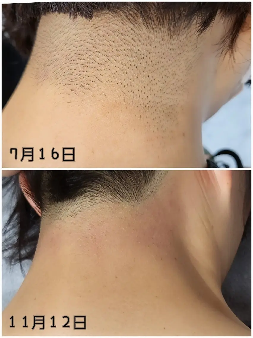脱毛 Lino SALONのエステ・リラクイメージ
