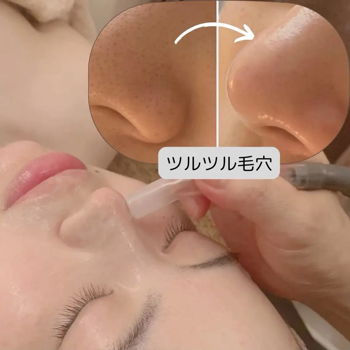 後藤 理恵（さとえ）のエステ・リラクイメージ