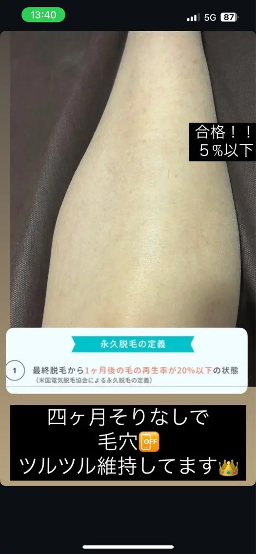 脱毛 大阪脱毛|ちぇるま| 眉毛Wax｜美肌管理のエステ・リラクイメージ