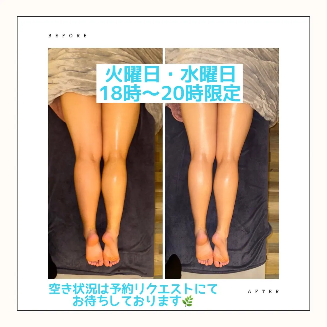 【下半身痩身ケア】初回お試し価格‼️の写真