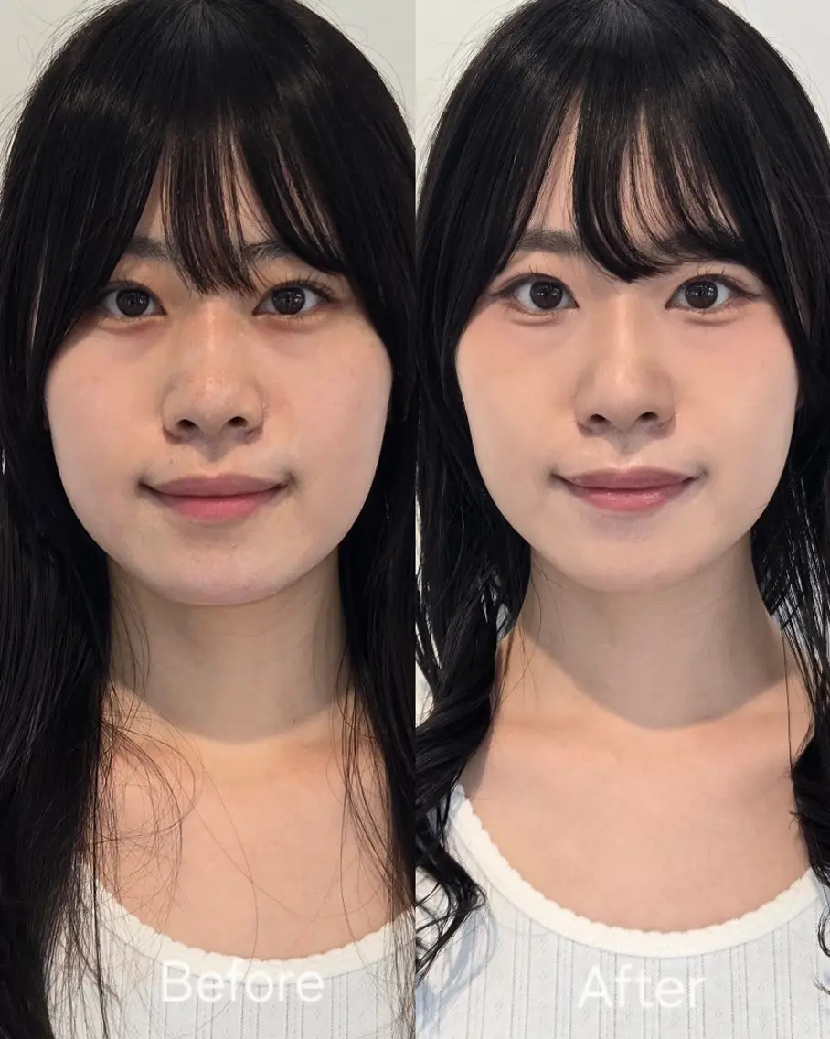 Hirali 韓国メイク🇰🇷のその他イメージ