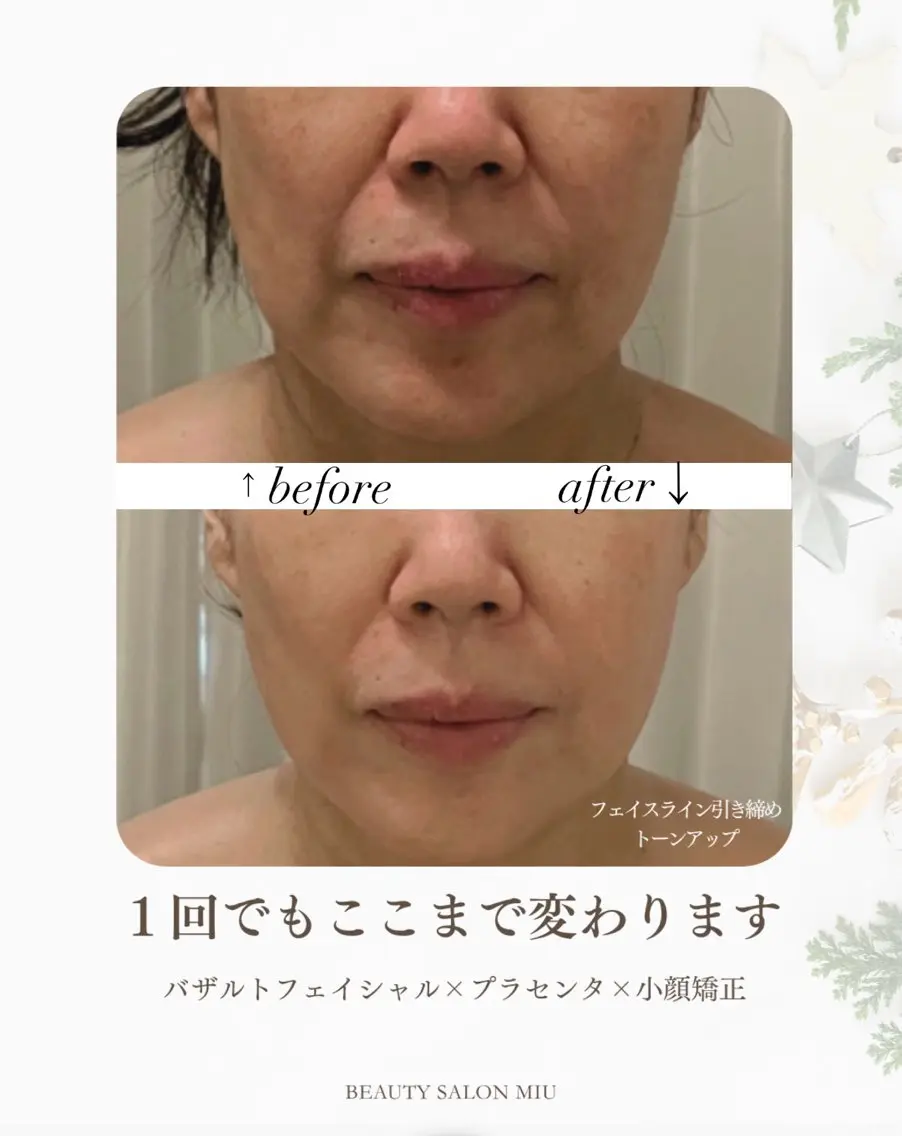 エステ 35歳からの エイジングケアサロンのエステ・リラクイメージ