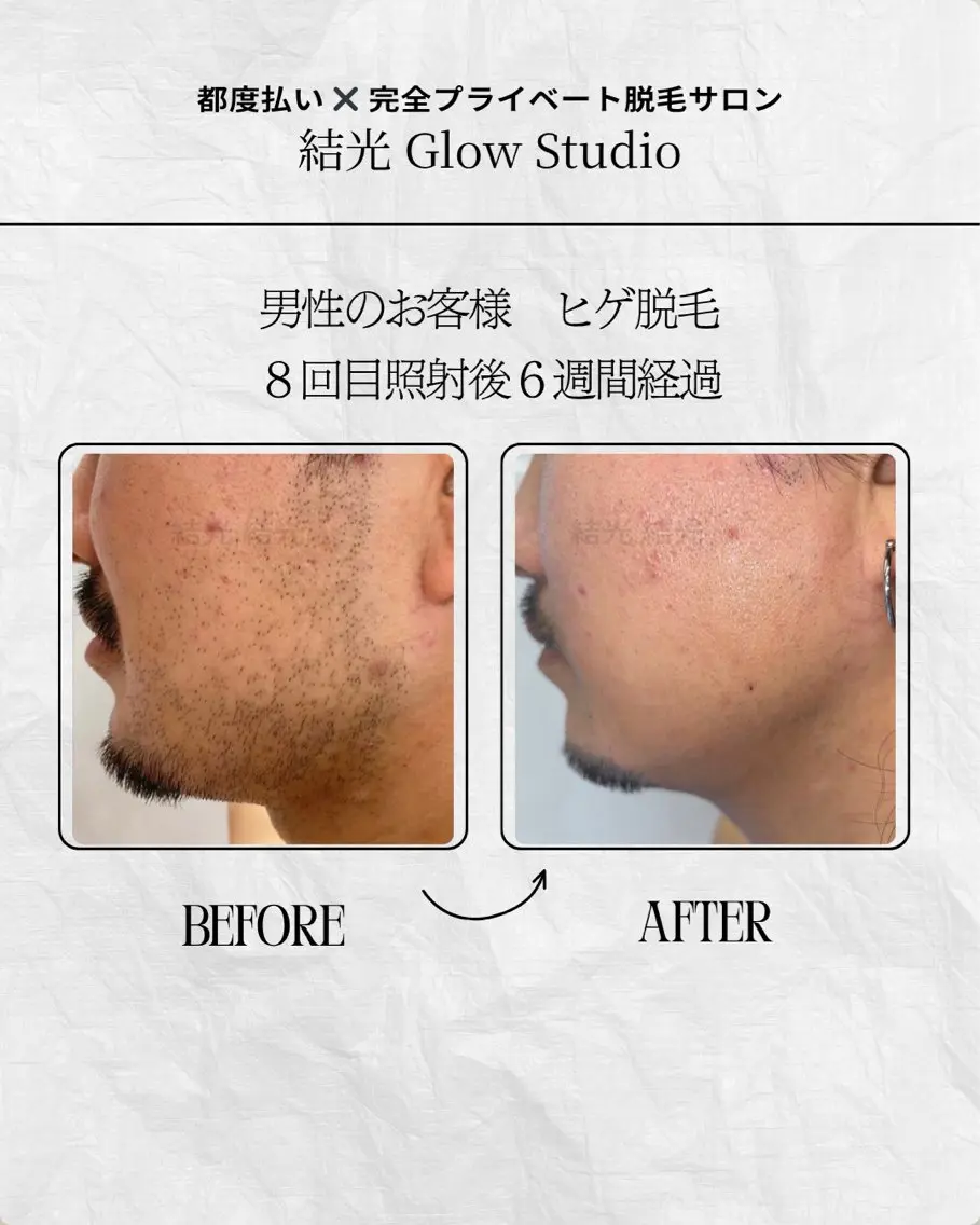 脱毛 結光Glow Studioのエステ・リラクイメージ